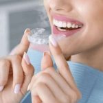 What to Expect from Your Invisalign Treatment in Sydney
