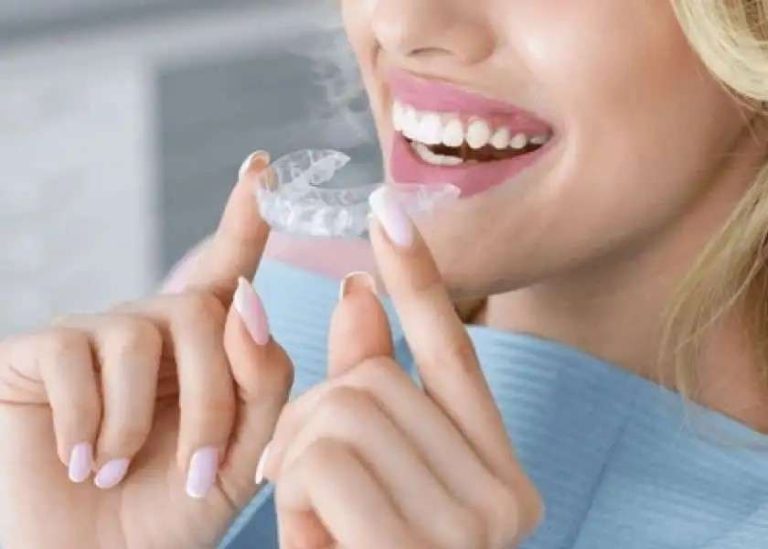 What to Expect from Your Invisalign Treatment in Sydney